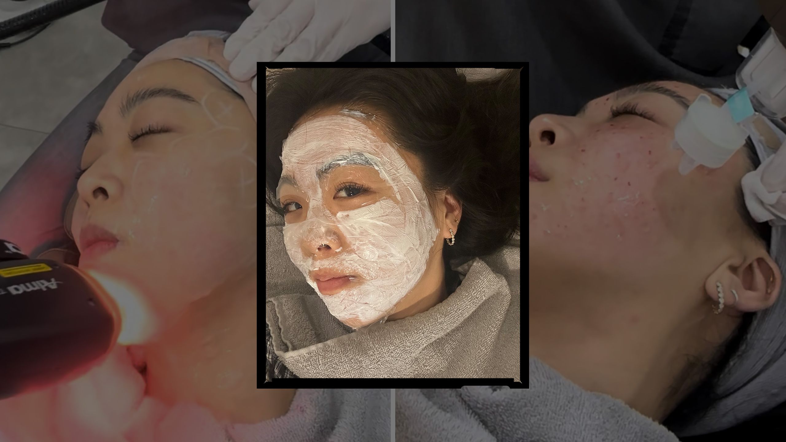 An Insider’s Guide to the Best Beauty Treatments in Seoul